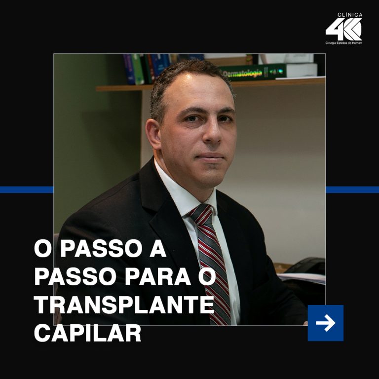 Passo a Passo do Transplante Capilar em Curitiba