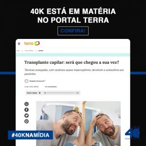 Transplante Capilar para Homens em Curitiba - Clínica Especializada